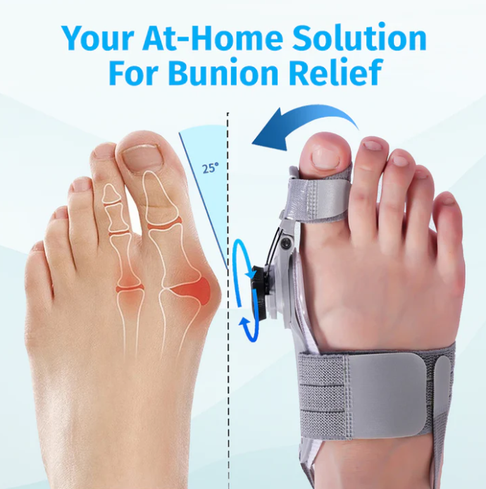 Treatmedy™ Bunion Fix — Toe Alignment Device for Foot Comfort