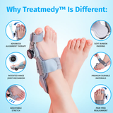 Treatmedy™ Bunion Fix — Toe Alignment Device for Foot Comfort