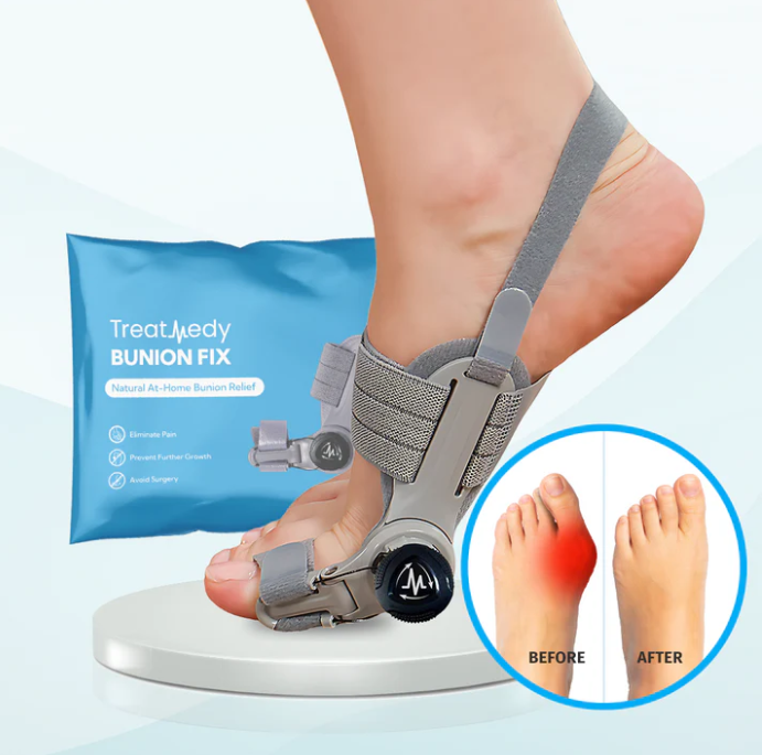 Treatmedy™ Bunion Fix — Toe Alignment Device for Foot Comfort